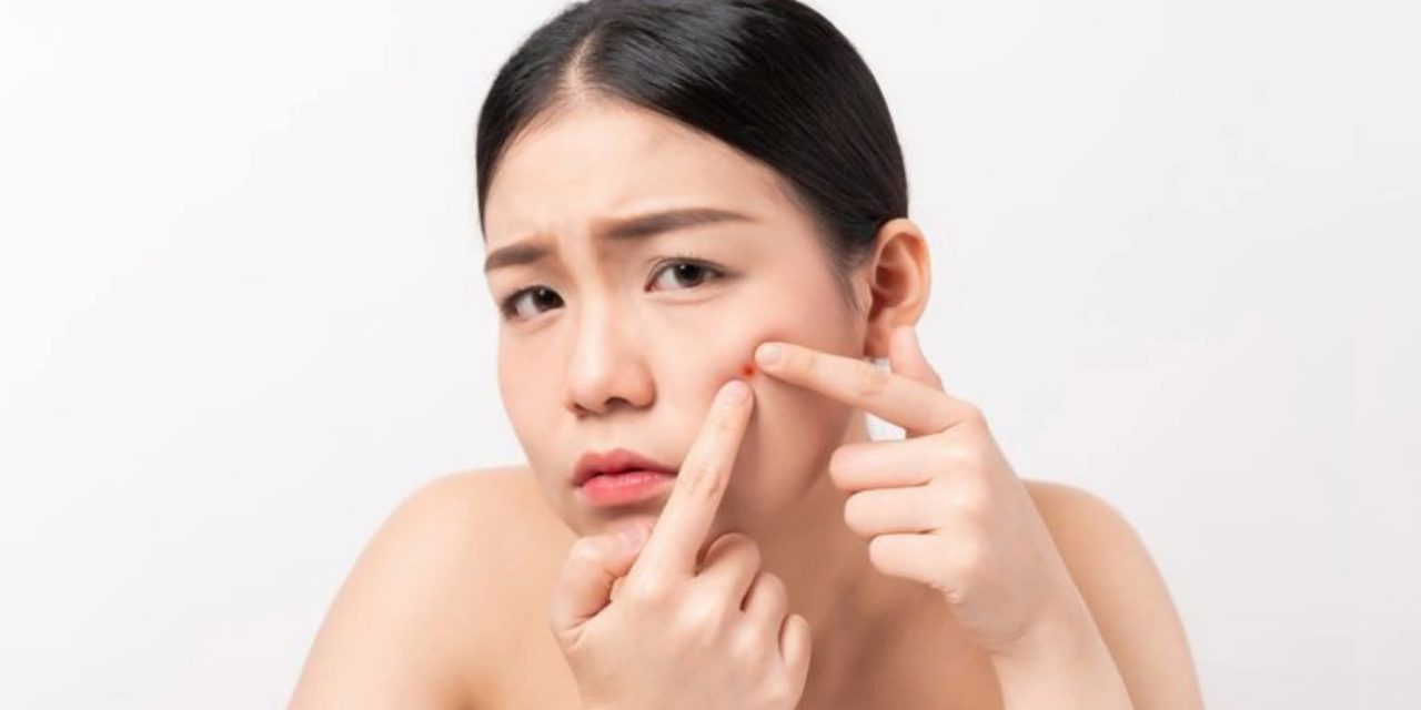 Layanan Kami: WAJAH BANYAK JERAWAT, INGIN LEBIH MEMIKAT